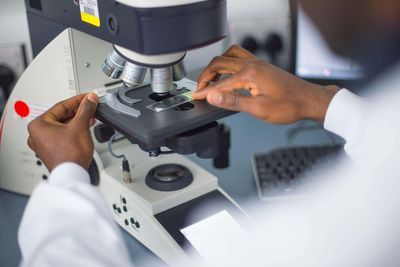 Lab workers balloted on strike action amid patient safety concerns