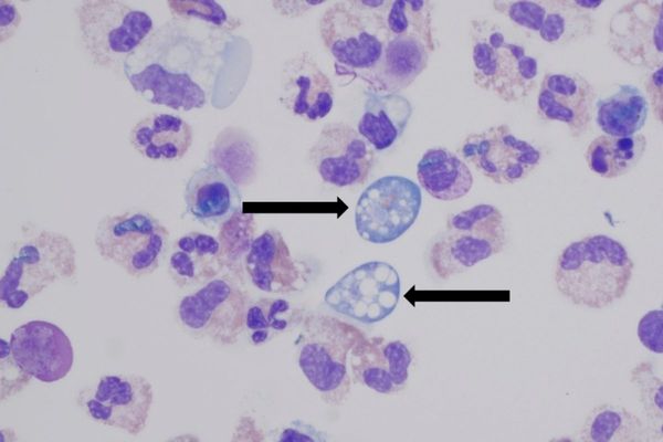 A woman contracted a fatal brain-eating ameba after rinsing her sinuses. Here’s how to avoid it